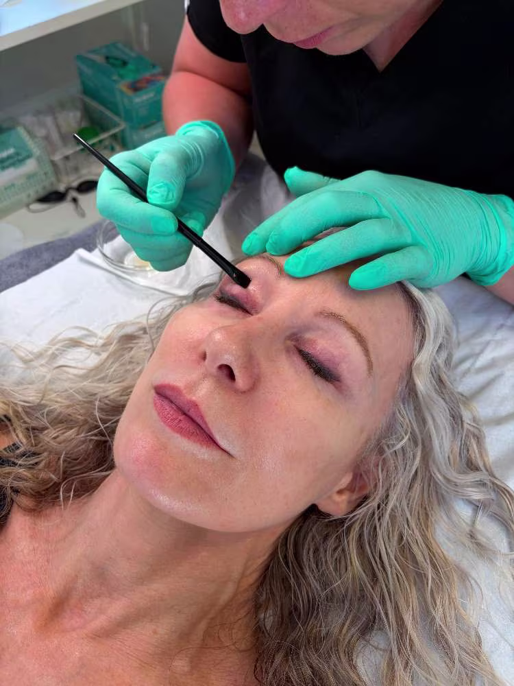 Perfect Glow Eye Contour Peel